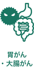胃がん・大腸がん